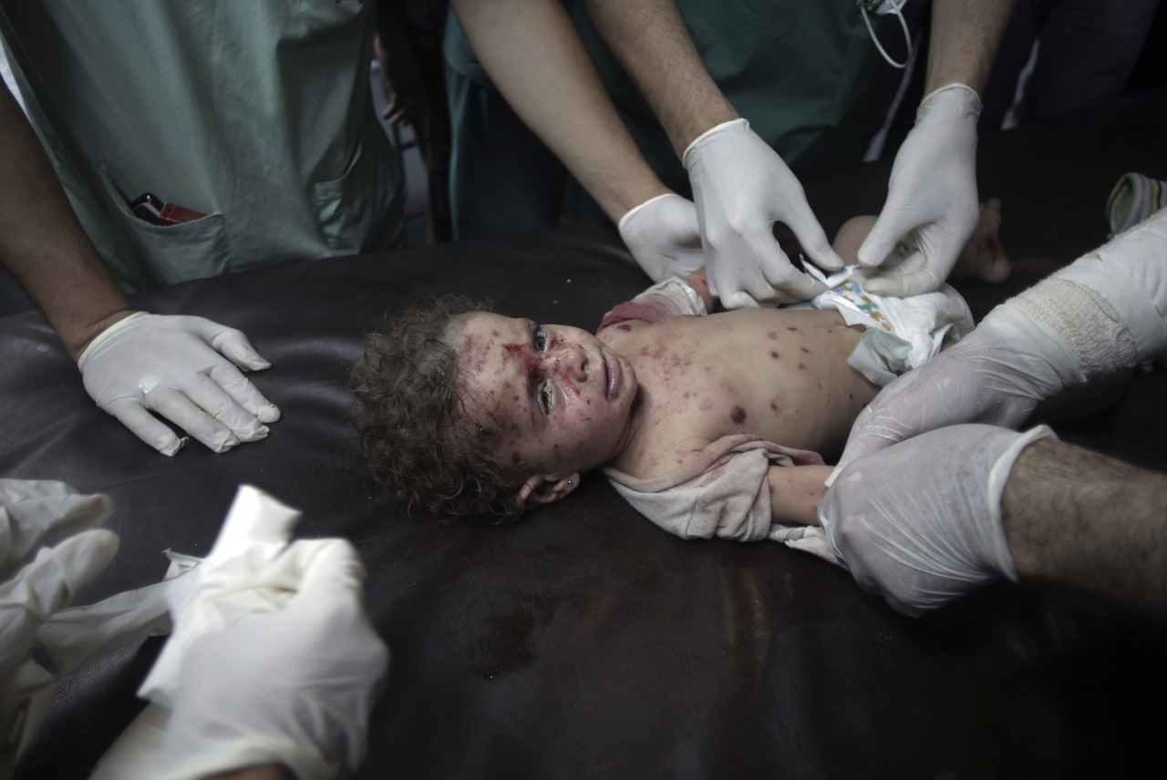 
LA TRAGEDIA DE LOS NIÑOS DE GAZA. El miedo, el hambre, la sed, el dolor, el desarraigo, la pérdida, la muerte. La cara de los chicos de Gaza, las víctimas indefensas de la escalada militar de Israel. (AP, AFP, REUTER)