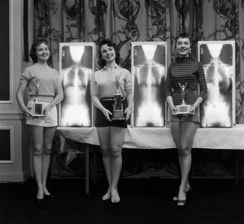 MIss Correct Posture (1956). In the 50’s and 60s’, American chiropractors held a series of rather unusual beauty pageants where contestants were judged and winners picked not only by their apparent beauty and poise, but also their standing posture, backed with X-rays of their spines. (Source)