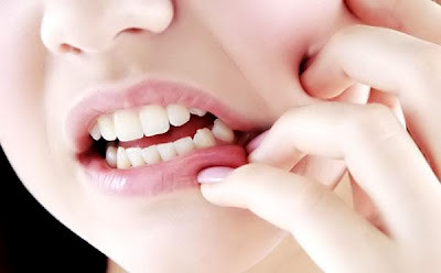 Abscess baby tooth gum line
