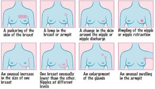 Lump on breast the nipple